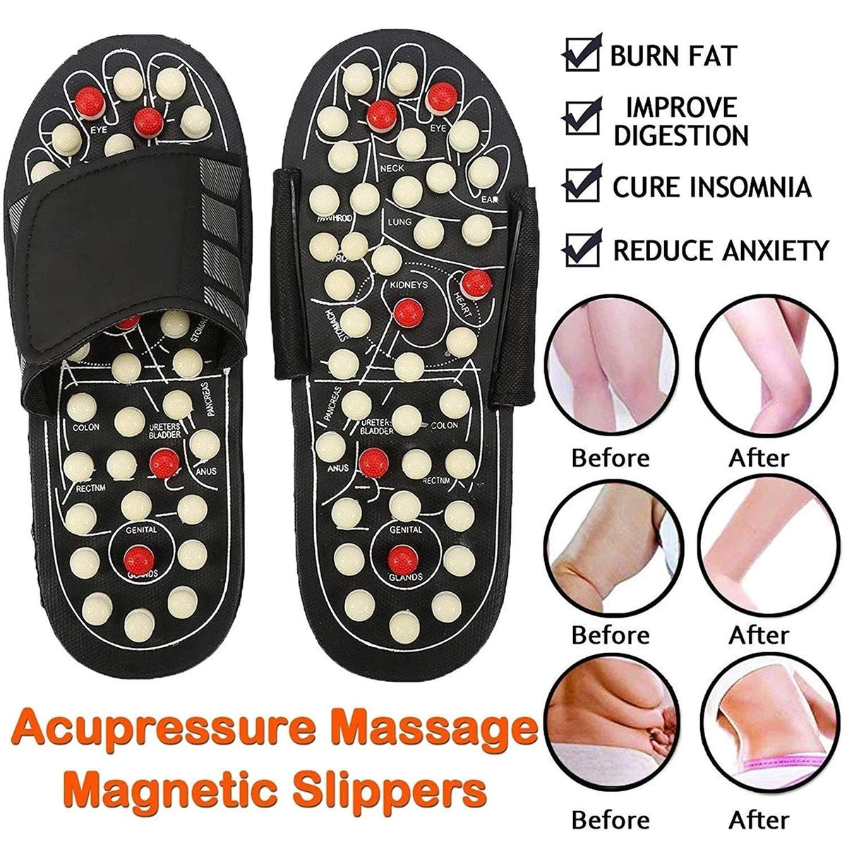 🔥Slippers met acupressuur en magneettherapie🦶