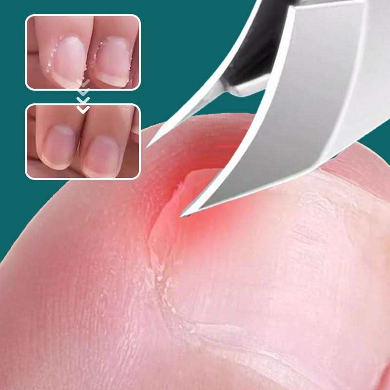✨Spatwaterdichte nagelverzorgingsset — Nauwkeurig, hygiënisch en draagbaar, perfect voor thuis of op reis!✨
