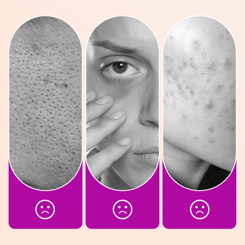 🔥Flawless verhelderende concealer voor onder de ogen