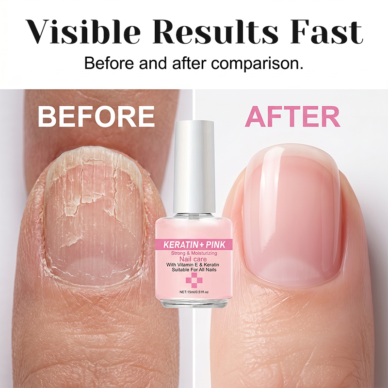✨Koop 1 krijg 1 gratis✨Keratine nagelversterker & -crème – Herstelt & geeft een glanzende finish 🌟