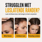 Koop 2, Krijg 1 GRATIS – Lace Fixatiespray voor Langdurige Hechting & een Onzichtbare Look